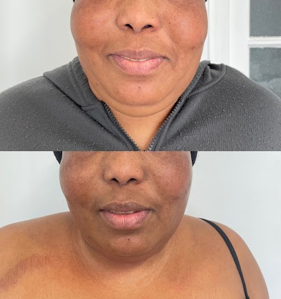 Awara Cryo Sculpt amincissement, minceur, musculation Seine saint Denis, Centre d'Amincissement au Blanc-Mesnil