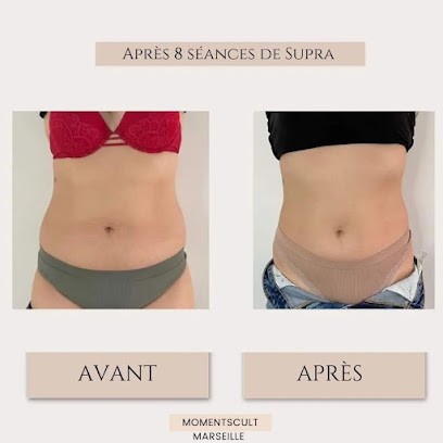 Suprascultmarseille.fr, Centre d'Amincissement à Marseille 10
